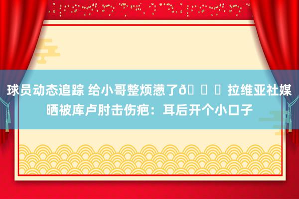 球员动态追踪 给小哥整烦懑了😅拉维亚社媒晒被库卢肘击伤疤：耳后开个小口子